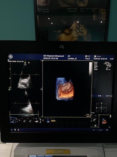 Gebraucht GE Healthcare Vivid E9 Ultraschall Gerät mit zwei Sonden