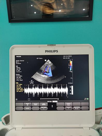 Used Philips CX50 Ultraschallgerät mit zwei Sonden