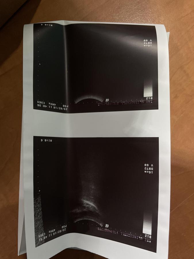 Gebraucht Siemens C364 Konvex Ultraschallsonde 