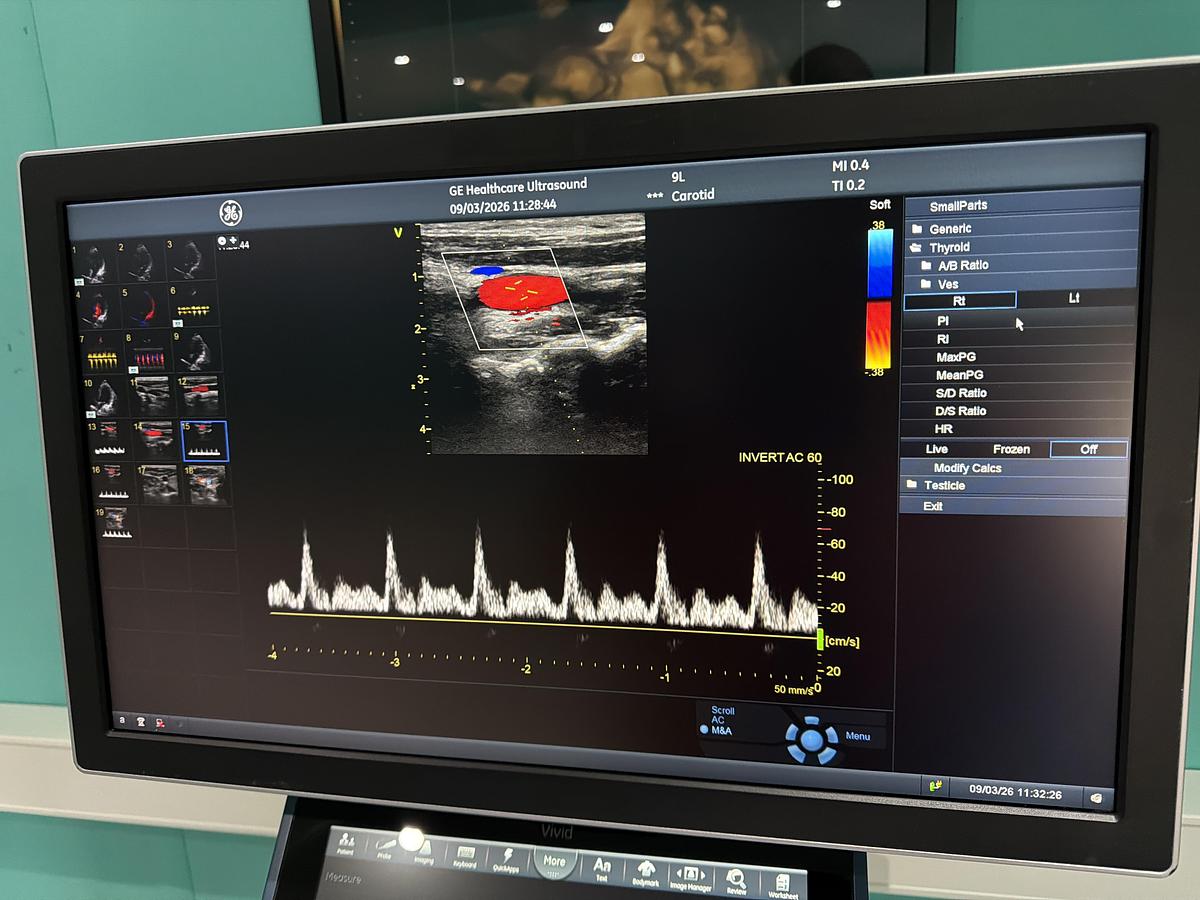 Gebraucht Vivid S70N Ultrasound 