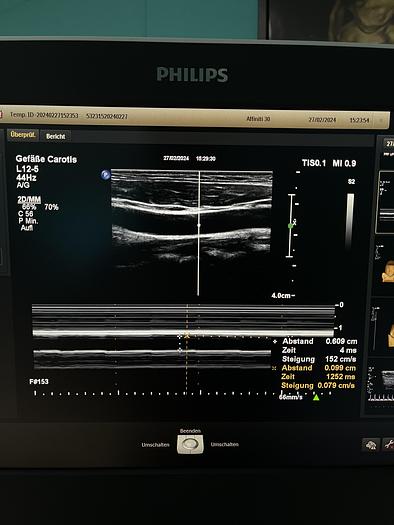 Used Philips Affiniti 30 Ultraschallgerät mit 3 Sonden und Drucker