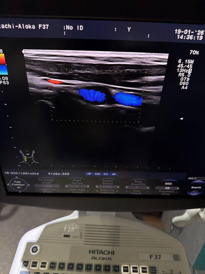 Gebraucht Aloka UST-568 Linear Ultraschallsonde