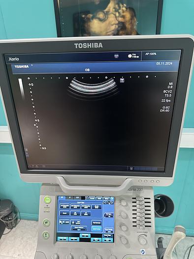 Used Toshiba Xario 200 Ultraschallgerät mit drei Sonden und Drucker 