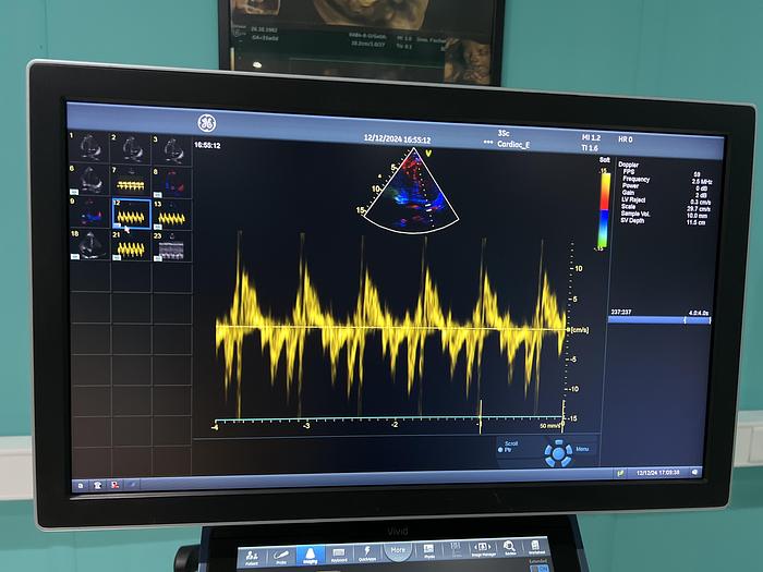 Used GE 3SC-RS Kardio Ultraschallsonde