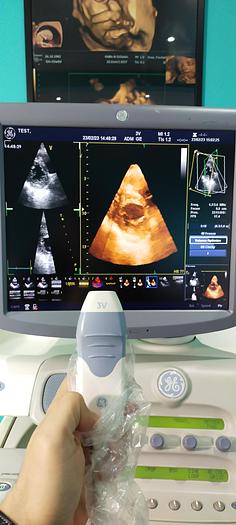 Gebraucht GE Vivid 7 Ultraschallgerät