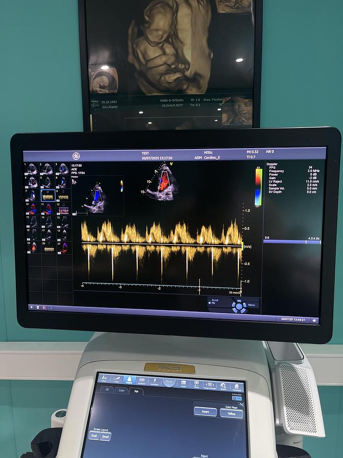 Gebraucht GE Vivid E95 V202 Ultraschallgerät mit M5Sc-D Kardiosonde