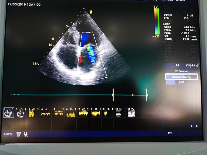 Gebraucht GE Vivid 7 Ultraschallgerät