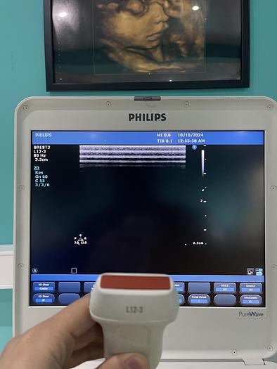 Used Philips CX50 Ultraschallgerät mit zwei Sonden