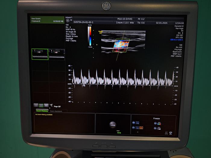 Gebraucht GE ML6-15-D Ultraschallsonde 
