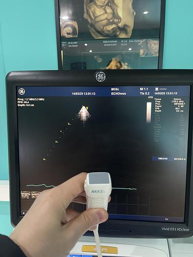Gebraucht GE Vivid E9 XDclear Ultraschallgerät mit zwei Sonden #2015 