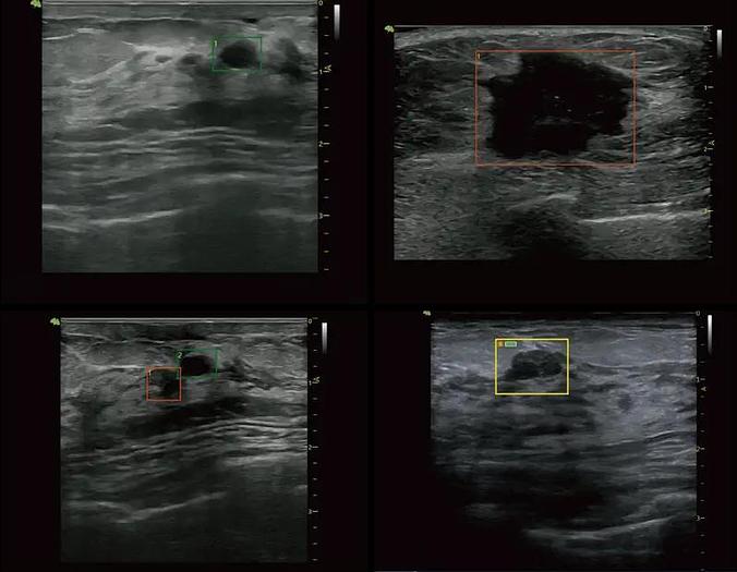 Vinno M86 Ultraschallgerät