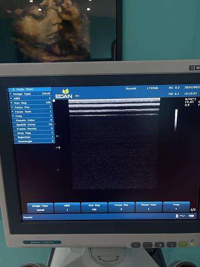 Used EDAN U2 Ultraschallgerät mit drei Sonden und Drucker