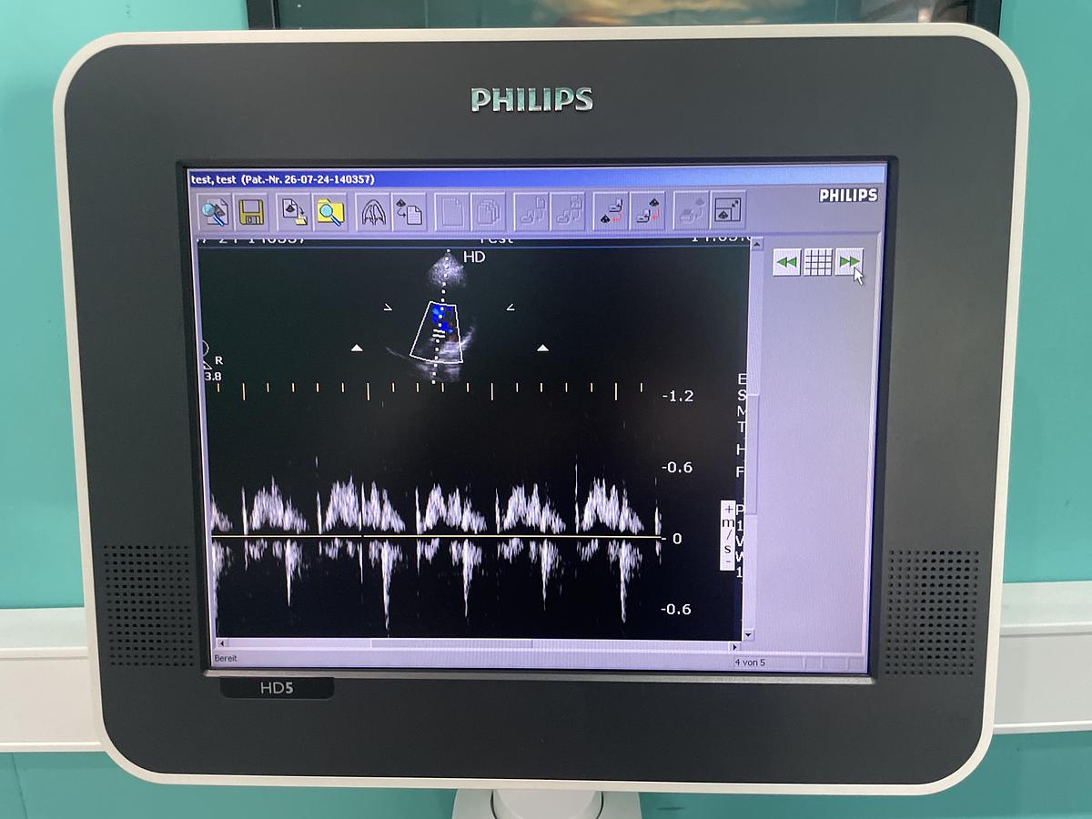 Gebraucht Philips HD5 Ultraschallgerät mit zwei Sonden und Drucker