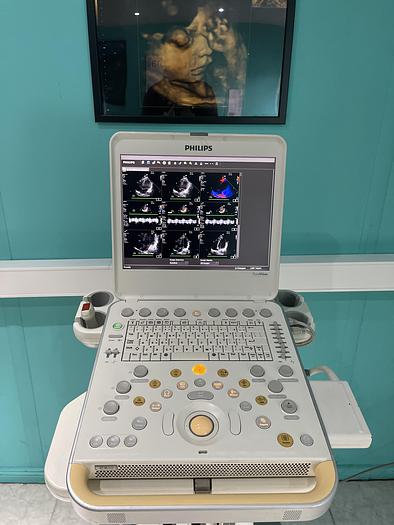 Gebraucht Philips CX50 Ultraschallgerät HW C.0 mit Sektor Sonde