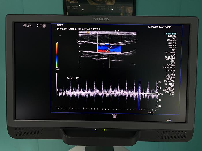 Gebraucht HELX Evoulution Acusion S2000 von Siemens Ultraschall Gerät mit drei Sonden