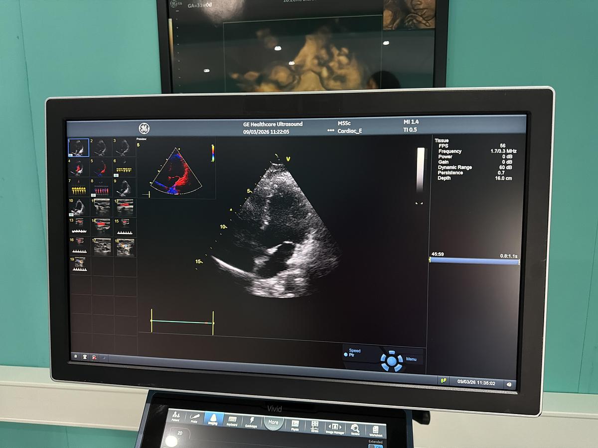 Gebraucht GE Vivid S70N Ultrasound 
