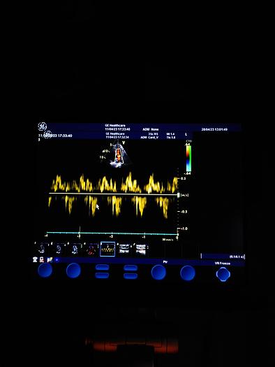 Gebraucht GE  Vivid S5  Ultraschallgerät auf Trolley mit 2 Sonden und EKG Kabel