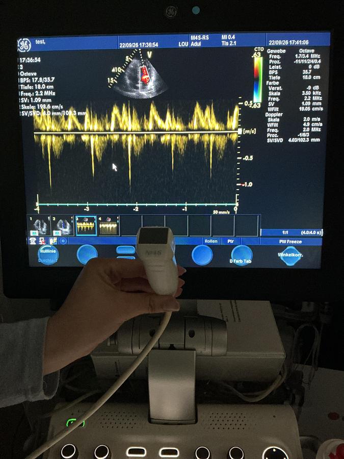 Gebraucht GE M4s-RS Kardio Ultraschallsonde