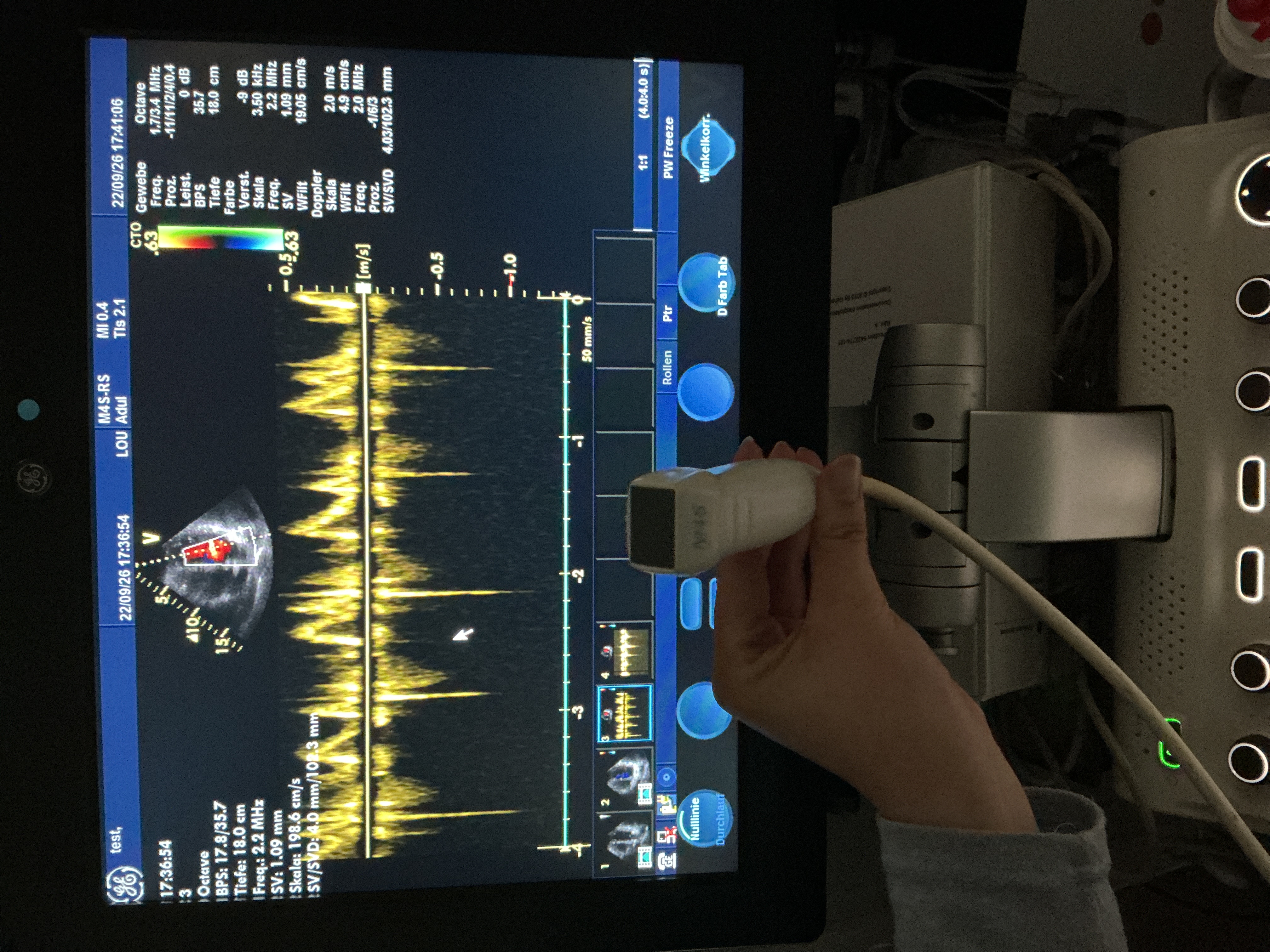 Gebraucht GE M4s-RS Kardio Ultraschallsonde