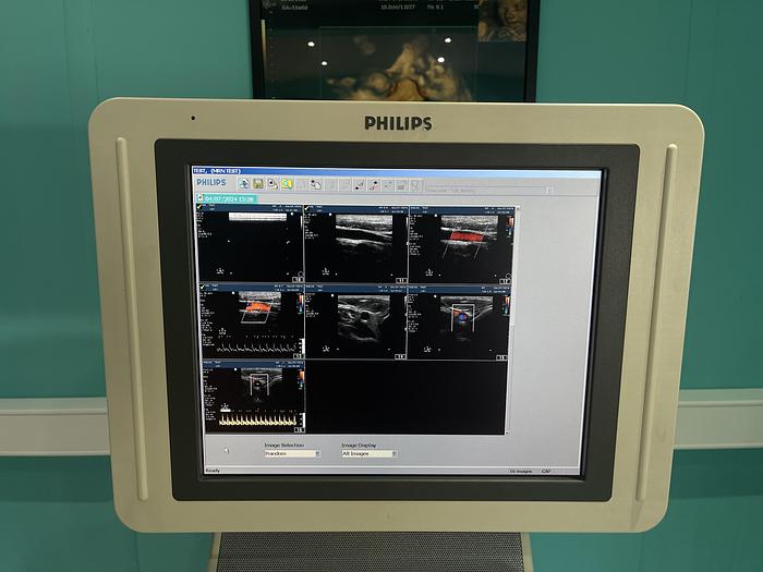 Used Philips HD 11 XE  Ultraschallgerät mit drei Sonden und Drucker