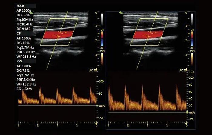 Vinno 5 tragbares Ultraschallgerät