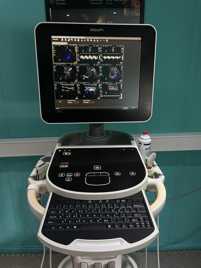 Gebraucht Philips Sparq Ultraschallgerät mit drei Sonden und Drucker