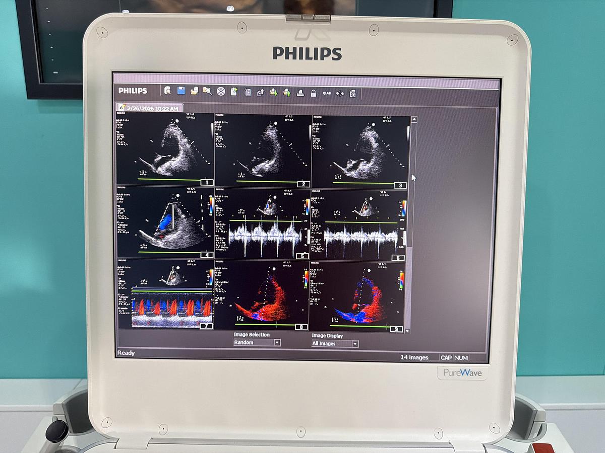 Gebraucht Philips CX50 Ultraschallgerät mit Sonde S5-1 auf Trolley