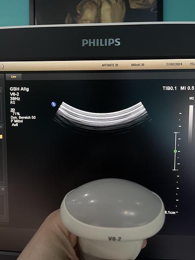 Used Philips Affiniti 30 Ultraschallgerät mit 3 Sonden und Drucker