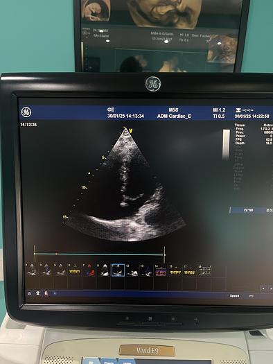 Gebraucht GE Vivid E9 Ultraschallgerät mit Kardiosonde und Drucker