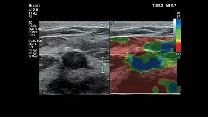 Philips Affiniti 70 Farbdoppler Ultraschallgerät