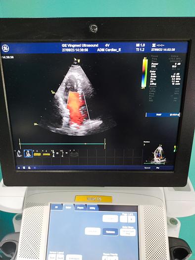 Gebraucht GE Vivid E9 Ultraschallgerät