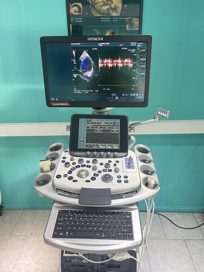 Gebraucht Hitachi ALOKA Arietta 850 Ultraschallgerät mit zwei Sonden und Drucker