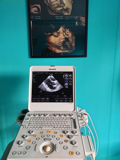 Gebraucht Philips CX50 Ultrasound with S5-1 and Trolly