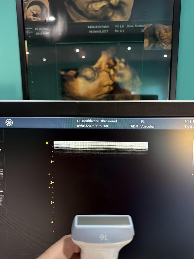 Gebraucht GE Vivid S70N Ultrasound 