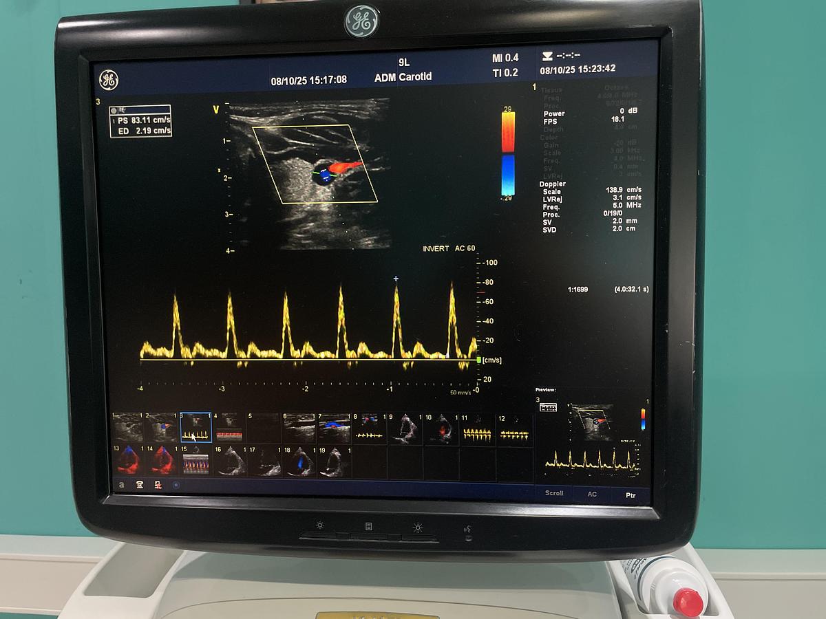 Gebraucht GE Vivid E9 Ultraschallgerät mit zwei Sonden und Drucker