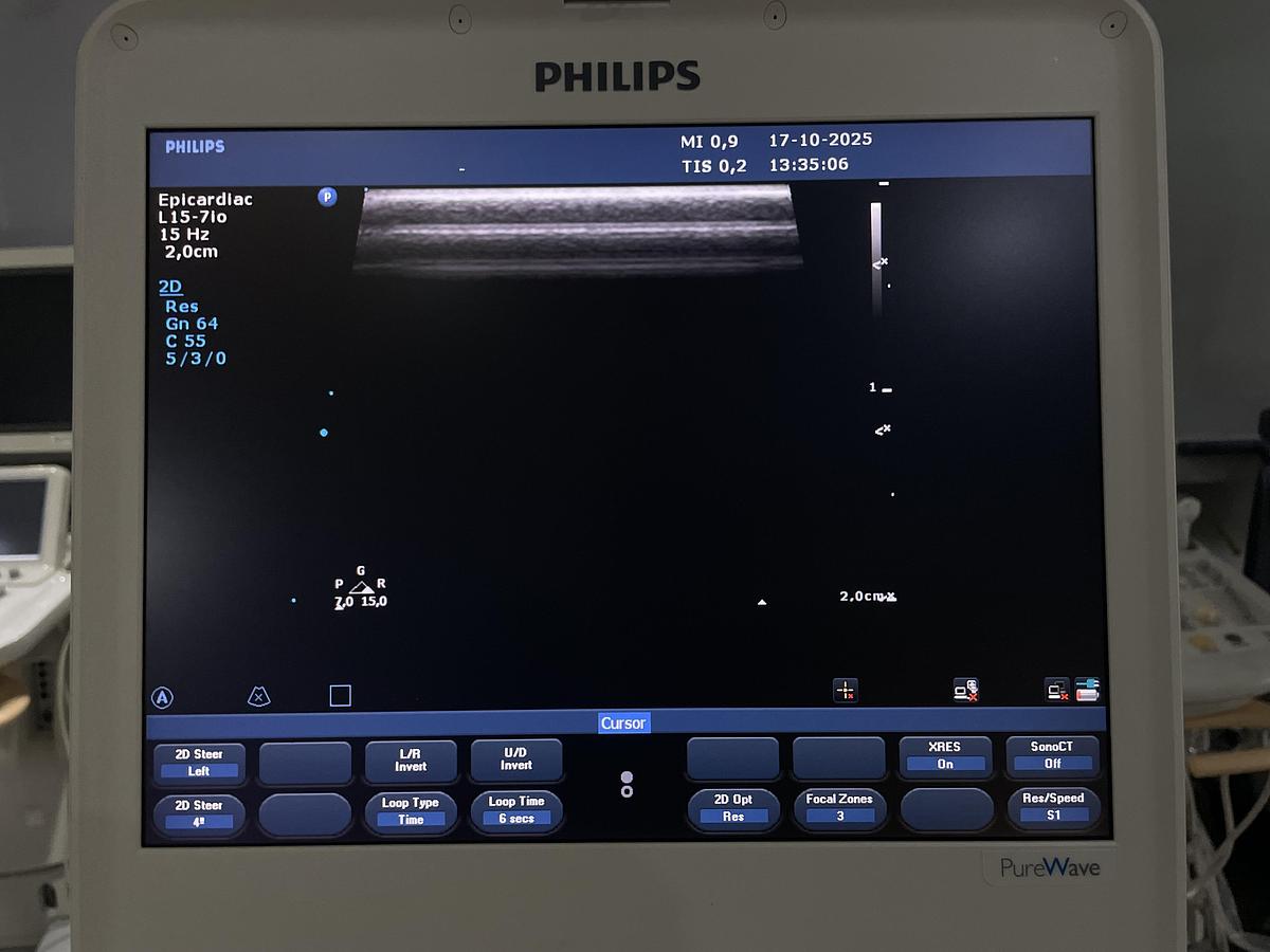 Gebraucht Philips L15-7io Linear Ultraschallsonde
