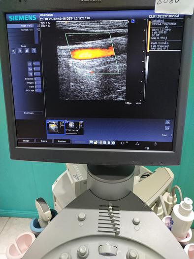 Gebraucht Siemens-Acuson-Antares Ultraschall Gerät mit vier Sonden