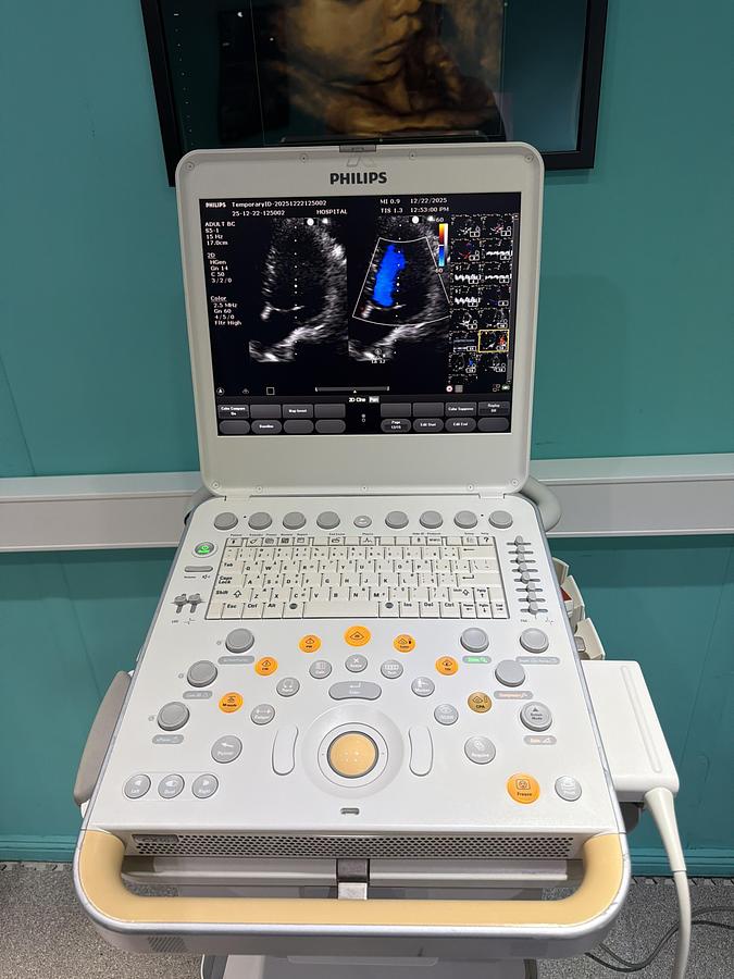 Gebraucht Philips CX50 SW 5.0.4 Ultraschallgerät mit S5-1 Kardiosonde