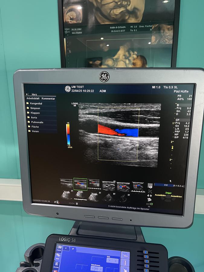 Used GE LOGIQ S8 Ultraschallgerät mit M5S-D kardio Ultraschallsonde und Drucker