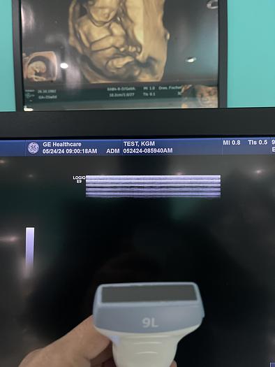 Gebraucht GE LOGIQ E9 XDClear 2.0 SW R6 Ultraschallgerät