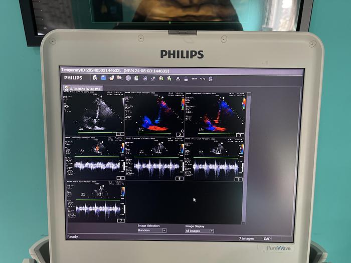 Gebraucht Philips CX50 Purewave Ultraschallgerät mit kardio Sonde