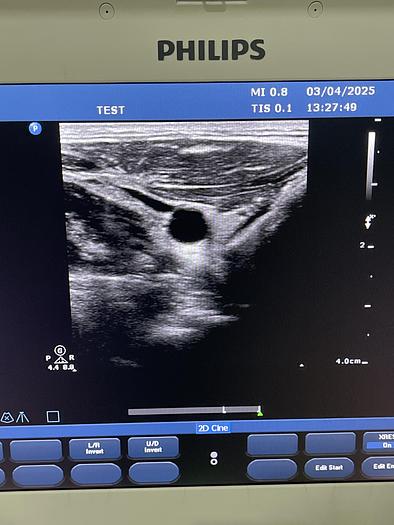Gebraucht Philips L12-3 Linear Compact Ultraschallsonde 