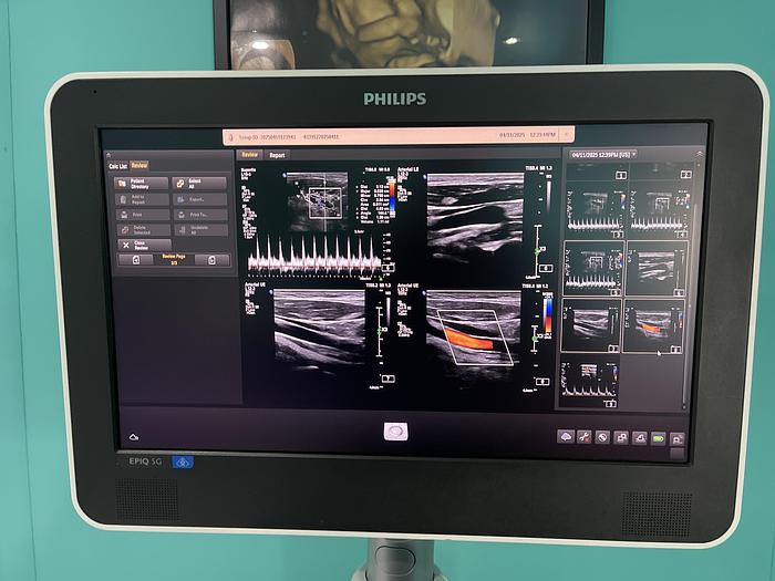 Gebraucht Philips EPIQ 5G Ultraschallgerät 