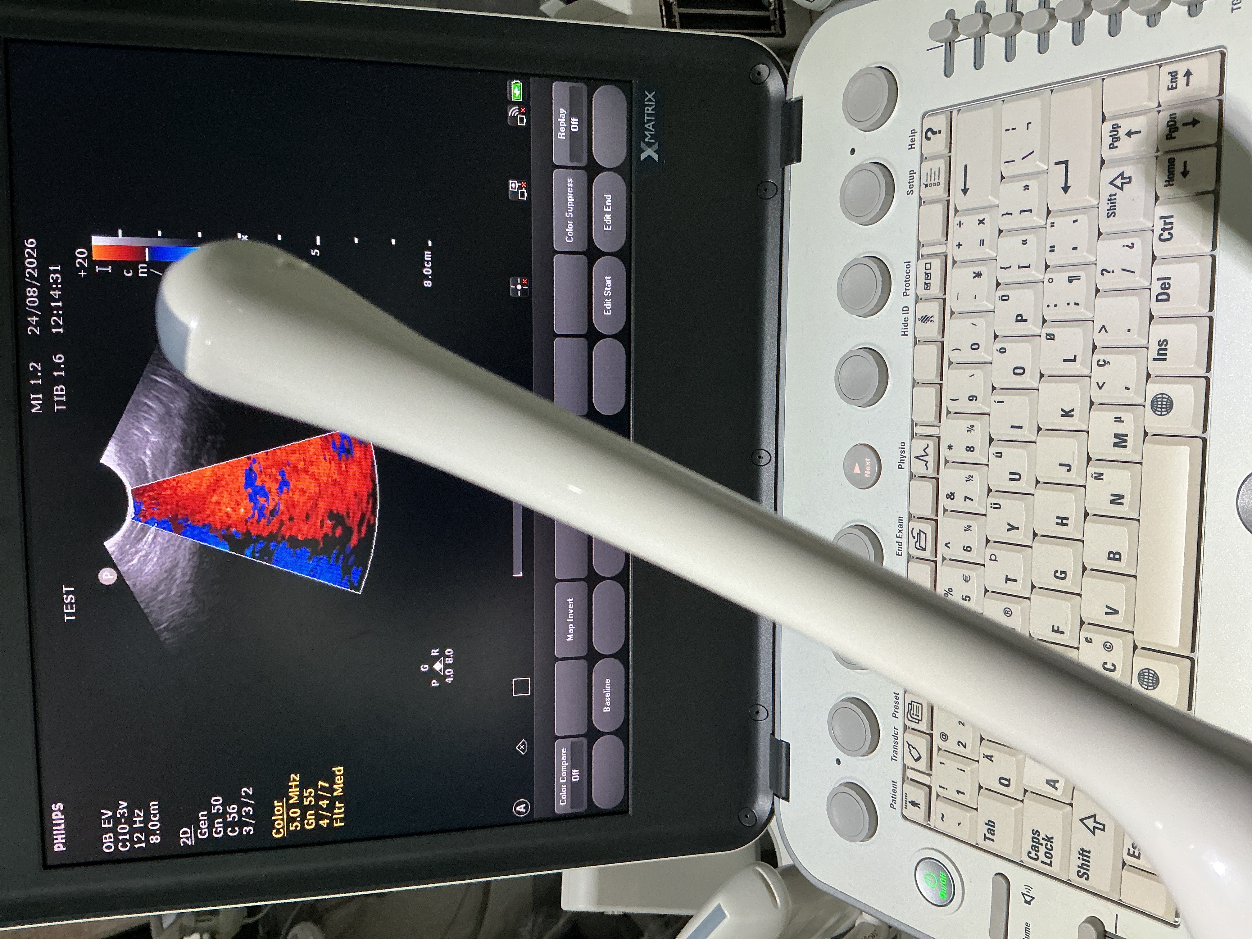 Gebraucht Philips C10-3V Endovaginal Ultraschallsonde