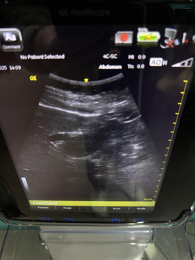 Gebraucht GE Venue 40 Ultraschallgerät mit Konvex Sonde