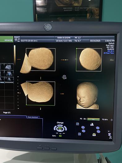 Gebraucht GE 3D/4D RAB4-8-D Ultraschallsonde
