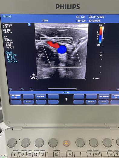Gebraucht Philips L12-3 Linear Compact Ultraschallsonde 