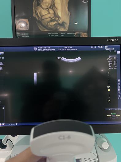Gebraucht GE LOGIQ E9 XDClear 2.0 SW R6 Ultraschallgerät