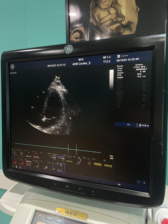 Gebraucht GE Vivid E9 Ultraschallgerät mit zwei Sonden und Drucker