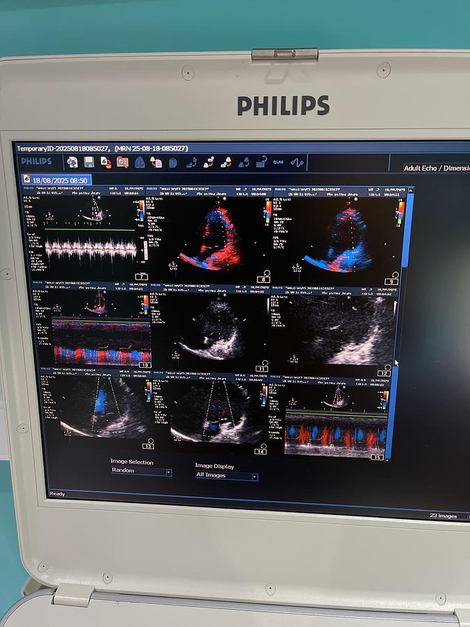 Gebraucht Philips CX50 Ultraschallgerät mit S5-1 Kardiosonde